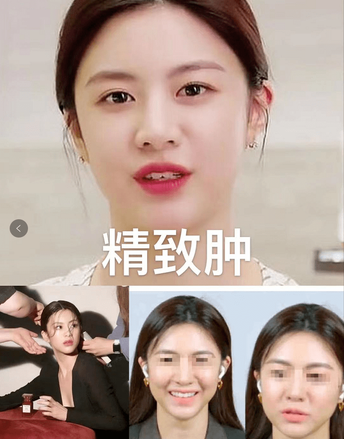 什么|越努力越没眼看，为什么南韩女明星个个精致又肿胀？