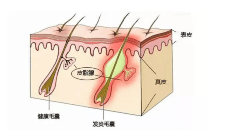 姐妹|夏季面膜该怎样选？