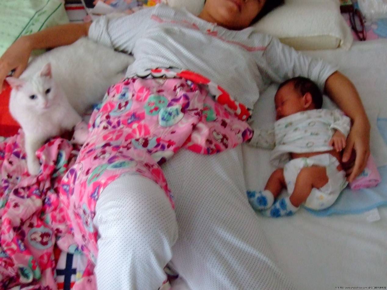 伤口|“横剖”与“竖剖”，哪个对二胎、三胎影响更大？这个选择很重要