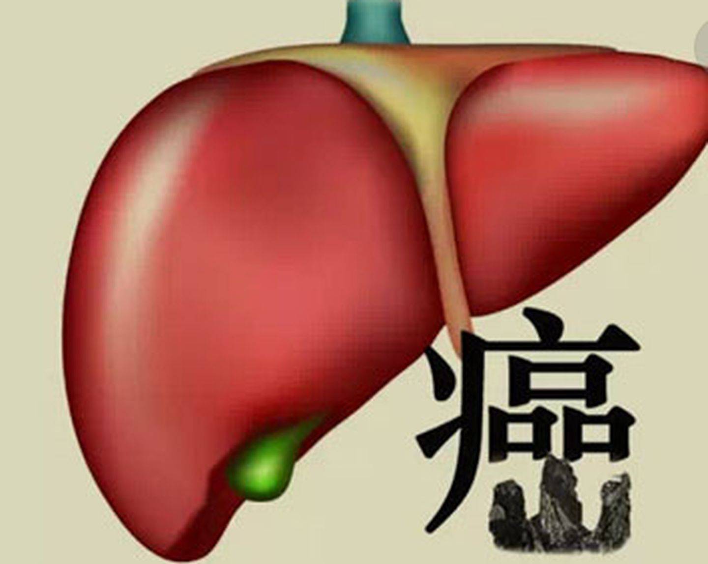 治疗|王安生医生指出，乙肝小三阳同样需要抗病毒治疗