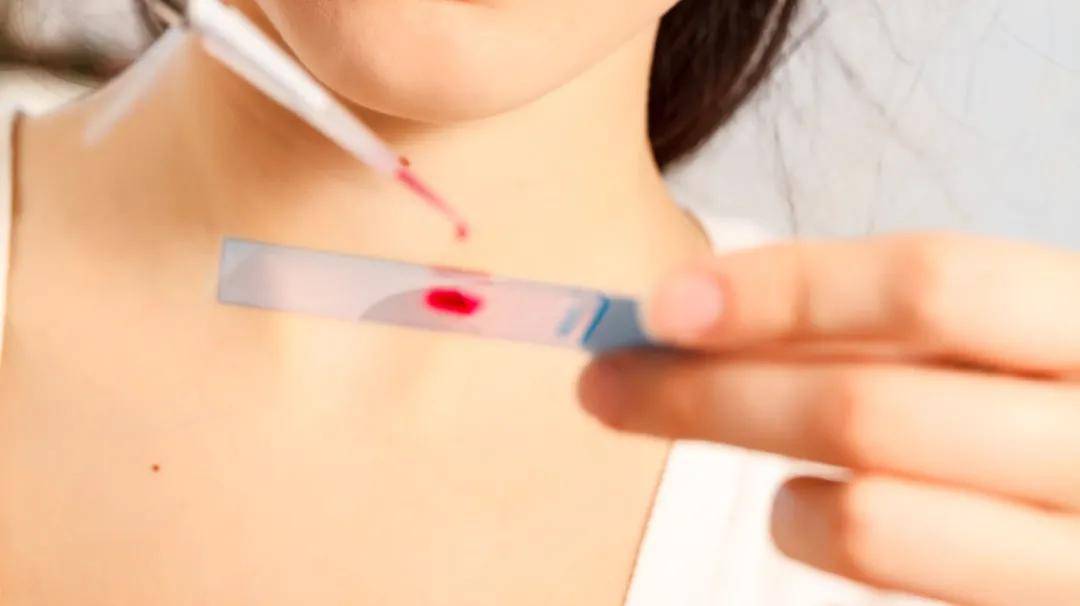 甲状腺|国康健康管家:体检报告中这些高异常指标,不用找医生,也能看懂了!