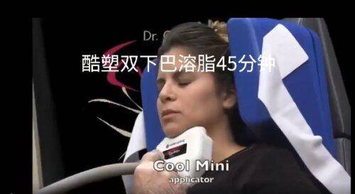 治疗|酷塑小头（cool mini）来袭，双下巴的实力克星！