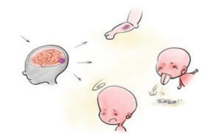 什么原因会引起脑部出血 3612f706c04647658846a4110d9890f0.png