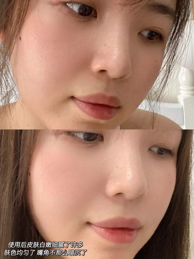 小玛|好用分享！今夏宝藏精华就是它，太惊喜了