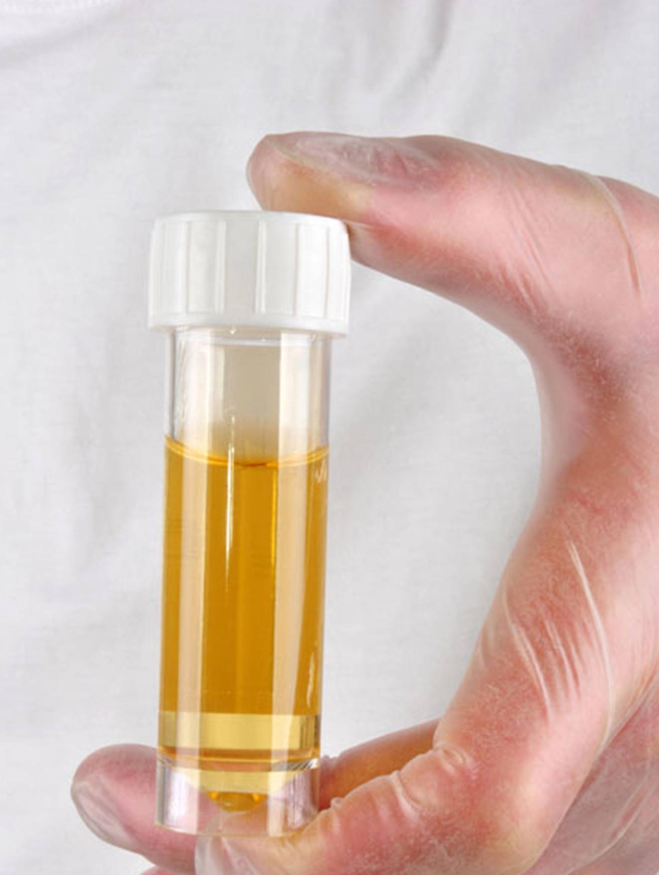 并发症|别让糖尿病伤肾拖成尿毒症，做好这3点很重要