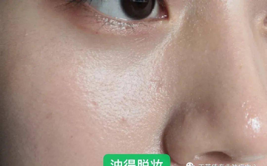 姐妹|痘痘肌化妆教程，小心机已经收藏了！