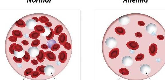 肾脏|身体近日有这3个反常,肾脏在“衰竭”的路上,莫大意
