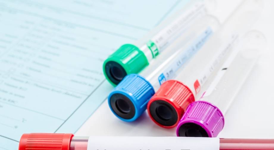 空腹|乙肝五项指标怎么看?查出这2项呈阳性,警惕是大小三阳,要复查