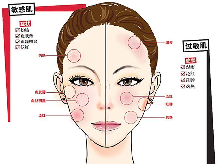 防晒品|素源分享| 敏感还是过敏？真不一样