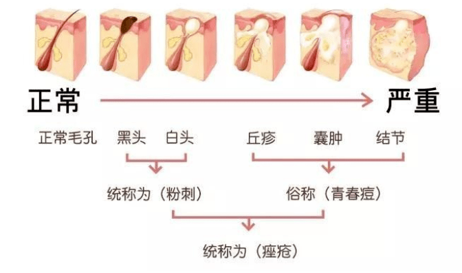 肠道|反复长痘,你护肤的手法正确吗?
