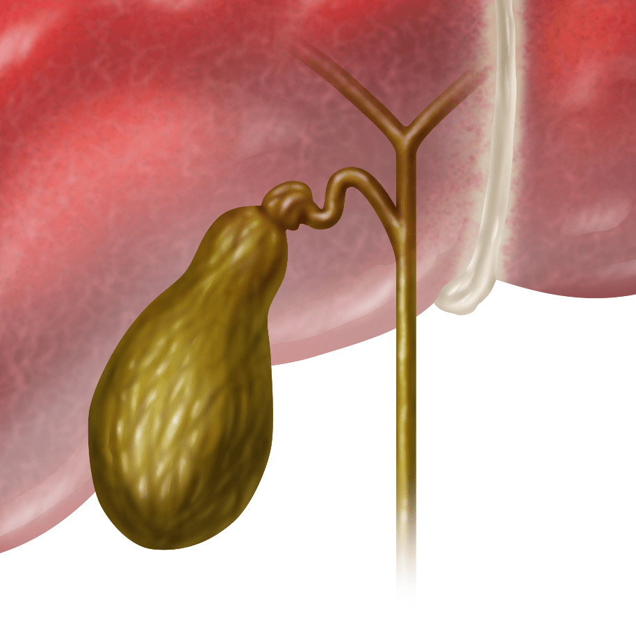 淋浴|胆道引流患者要注意些什么？