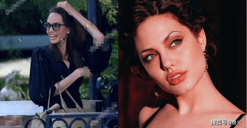 状态|安吉丽娜朱莉现身街头被拍！露齿大笑脸颊凹陷，手臂干瘦青筋暴起