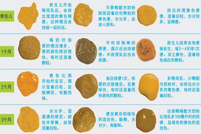 八个月宝宝正常大便什么颜色 a3fab0eb28dd4801823afc0e76a846e4.jpeg