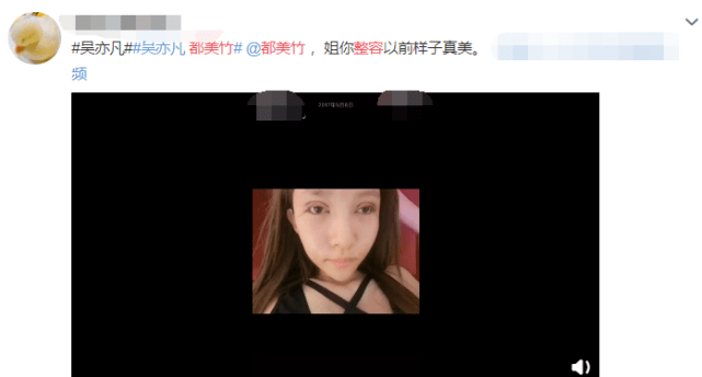 都美竹子整容前的照片图片