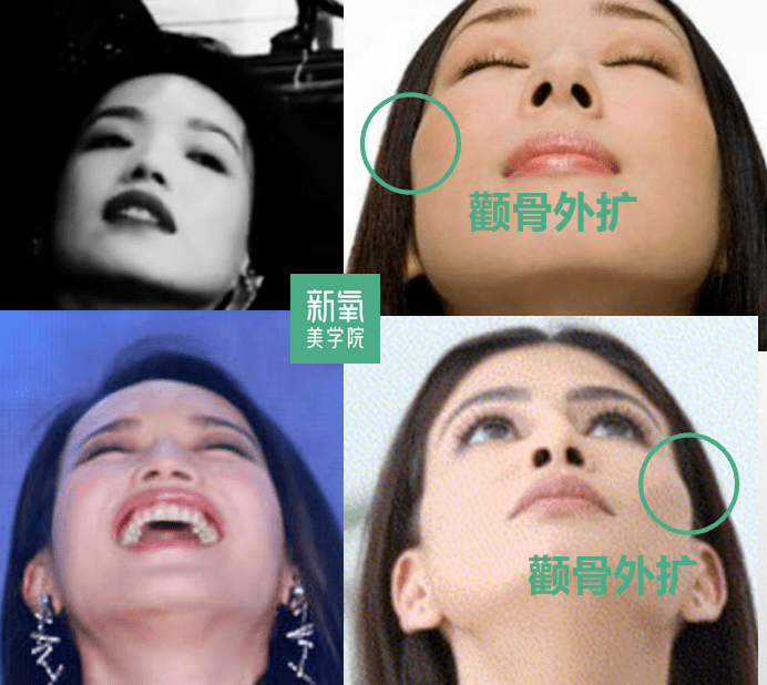 眉骨|给赵露思换了天使大宝贝的眉骨和眼眶骨，这张脸洋气指数飙升120%