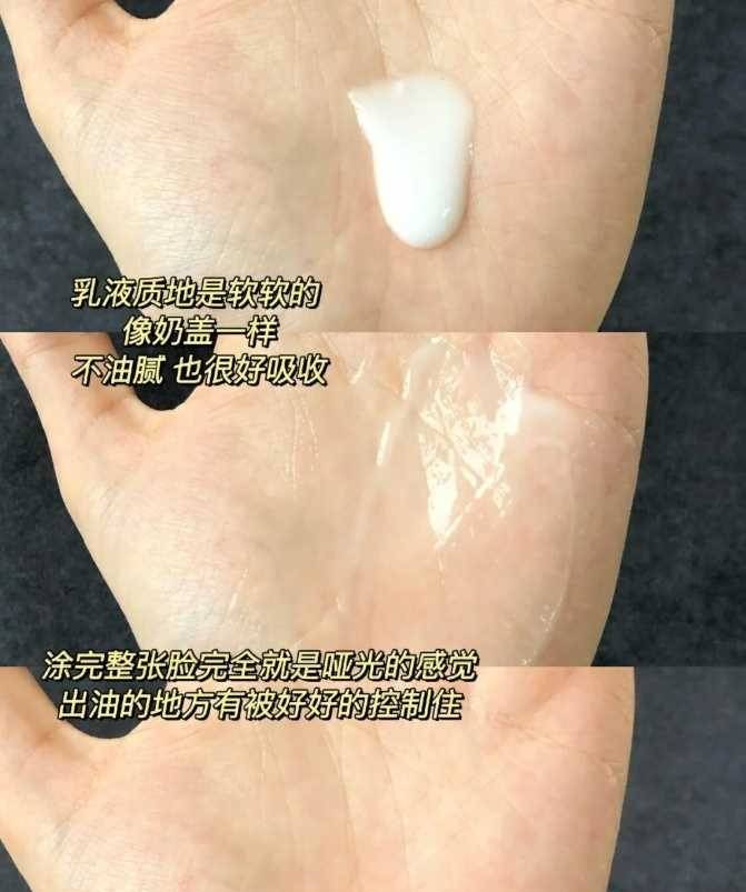 长痘痘|夏天,油皮护肤该怎么做?这份最全“控油”指南,值得收藏!