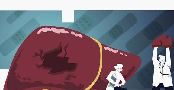 肝脏|肝癌多是“拖”出来的，4个部位出现异常，可能是肝病来袭