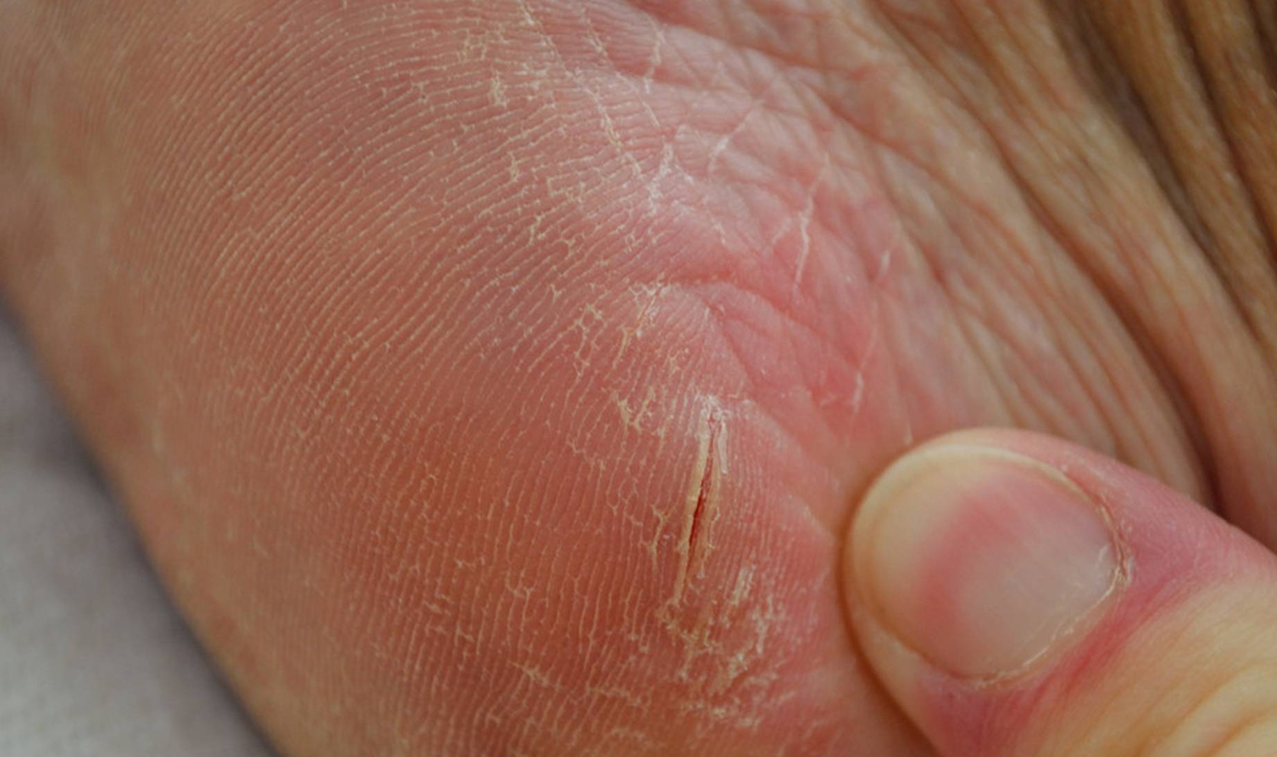 下半身|女性衰老的标志:下半身可能会“露出马脚”,不妨自查一下