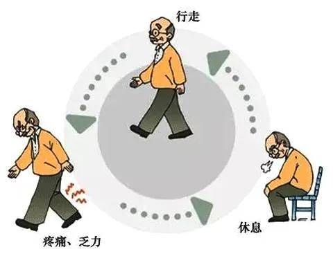 孔镜|76岁大妈经常“走走停停” 专家：当心腰椎管“缩水”