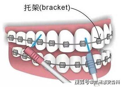 一般多久开始说话 1274cfd439524d4783d11c1daaeebafa.jpeg
