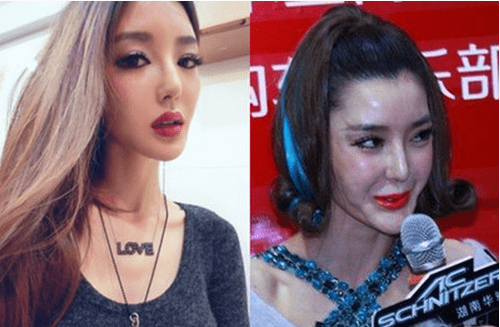 他们本来就很美,却硬要整容把自己整残