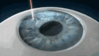 什么是飞秒和半飞秒 95b26589d8124f4c8129c13d89fc7d66.gif