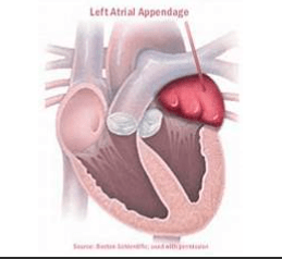 血糖|50岁男子，突发脑梗？医生提醒：远离脑卒中，做到“四个坚持”