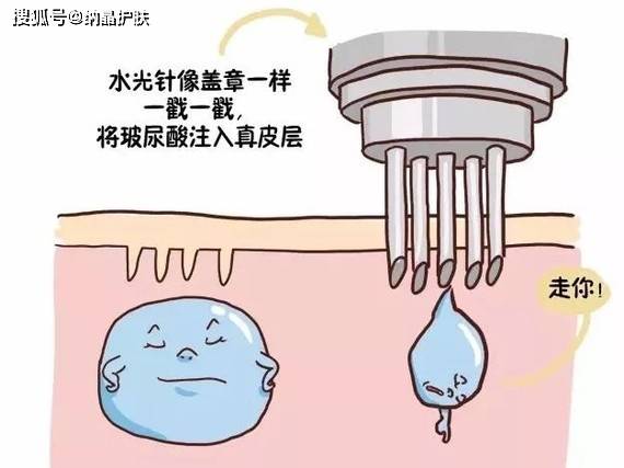 体细胞|补水效果胜过N张面膜，水光真有这么好吗？