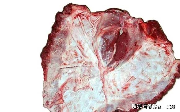 身上肉跳是长肉吗 8b272620b86f49d2821611cdf22cb866.jpeg