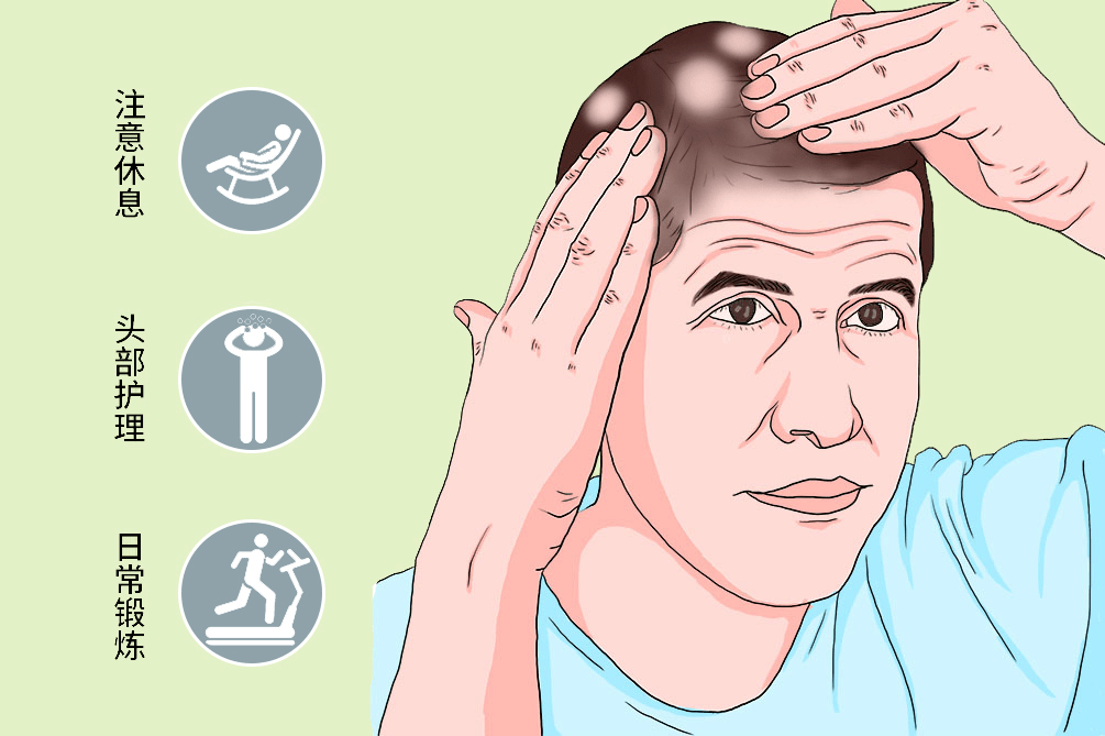 头发|?丨康复馆丨80后的头发去哪了?