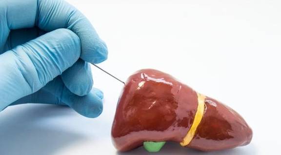 治愈|乙肝“大三阳”和“小三阳”哪个更严重？出乎意料！