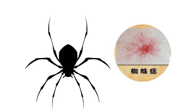 治疗|肝癌一发现就是晚期？4个信号别大意，肝部或正遭受癌细胞侵袭