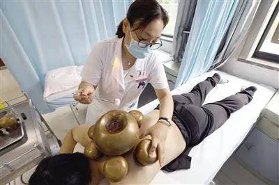 西安市|丨媒体报道丨火罐“拔出”中医热