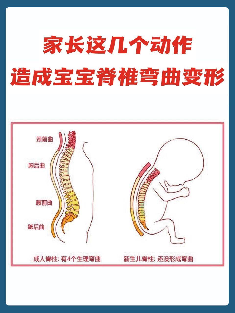 儿童腰部脊柱凸起图片
