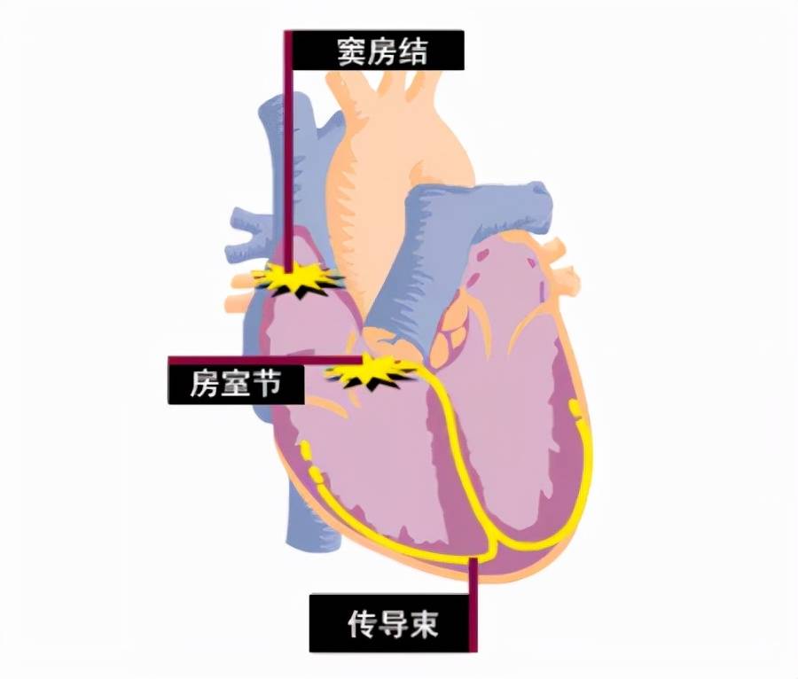合并|房颤是心脏病吗?对人体有哪些危害?医生给你解疑答惑