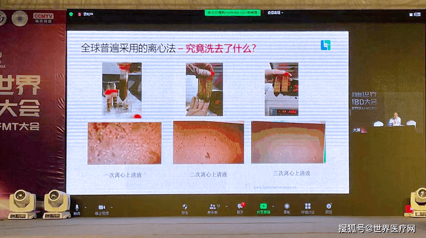 途径|菌群移植是“吃”进去的吗？