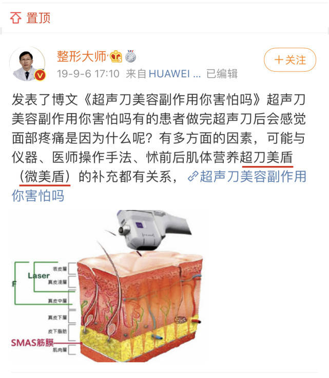 玛吉|超声刀是什么,准备做个超声刀去参加前任婚礼,社死的一天