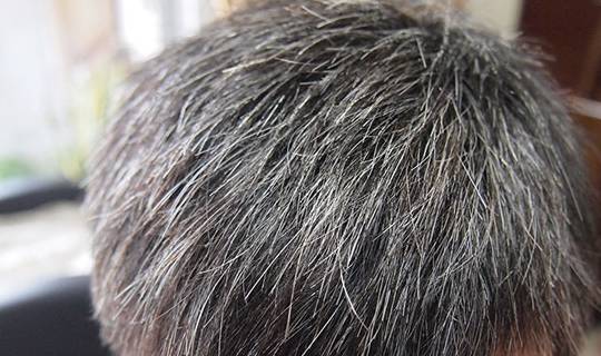 如何才能长白头发 4b0f3d9ac28a4cd8b0ef8bab56c2f294.jpeg