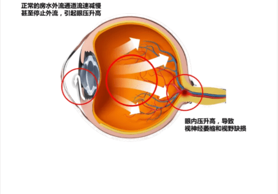3d94b99d9b6c420cab96c0003bc9395b.png