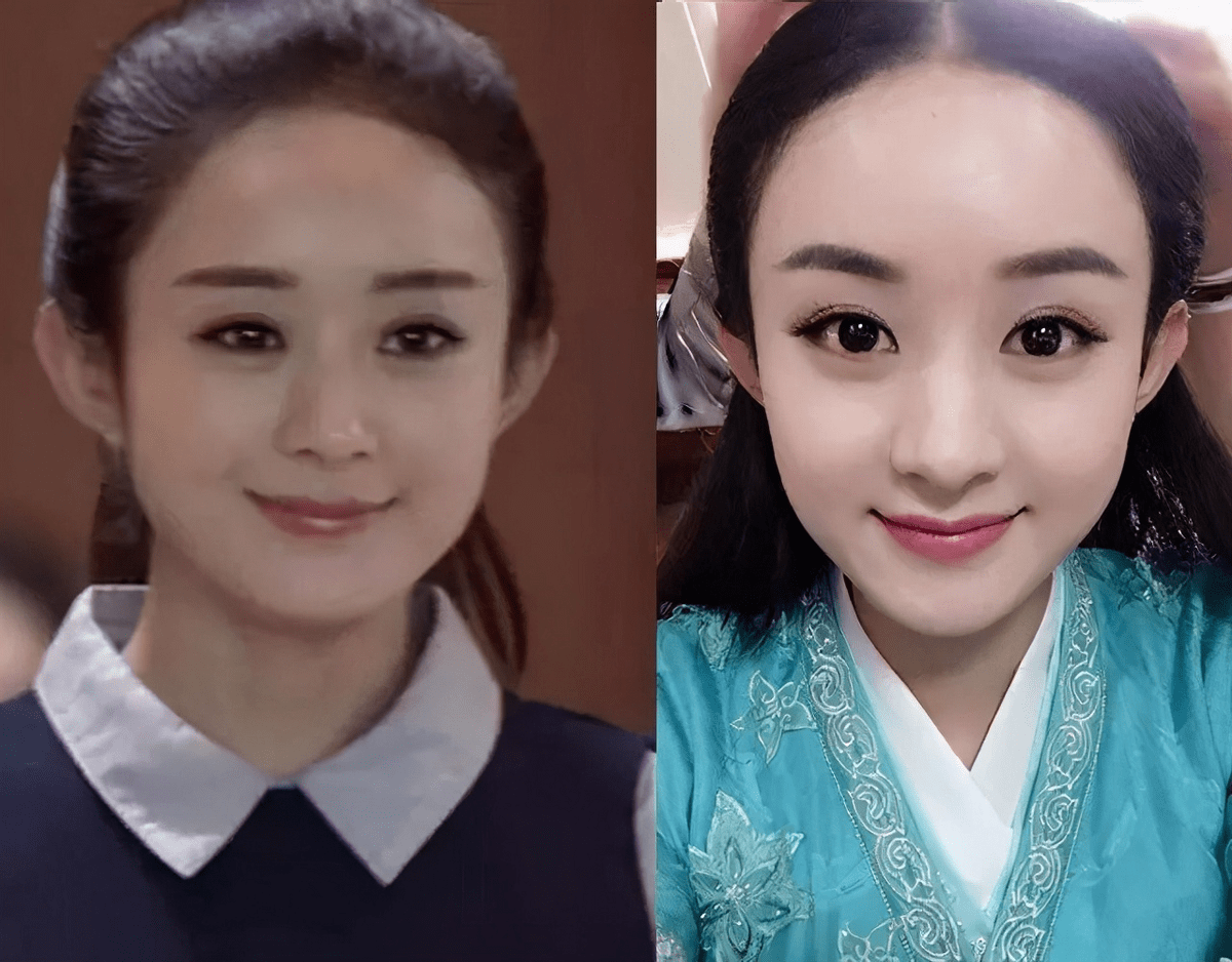 眼睛|什么样的长相特点会显“土味”？女明星都是怎样悄悄变精致的？