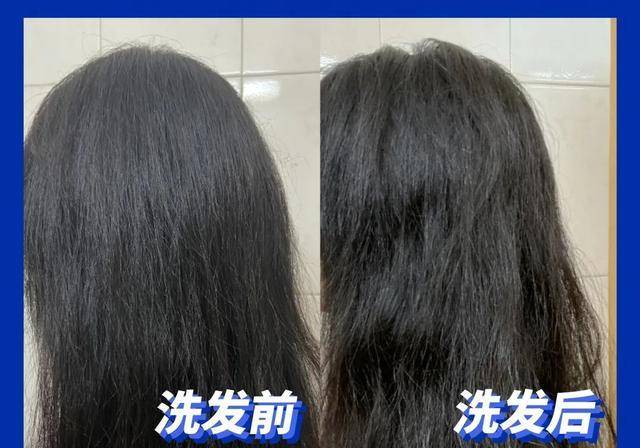 头皮|超难用的洗发水避雷，你中招了吗？