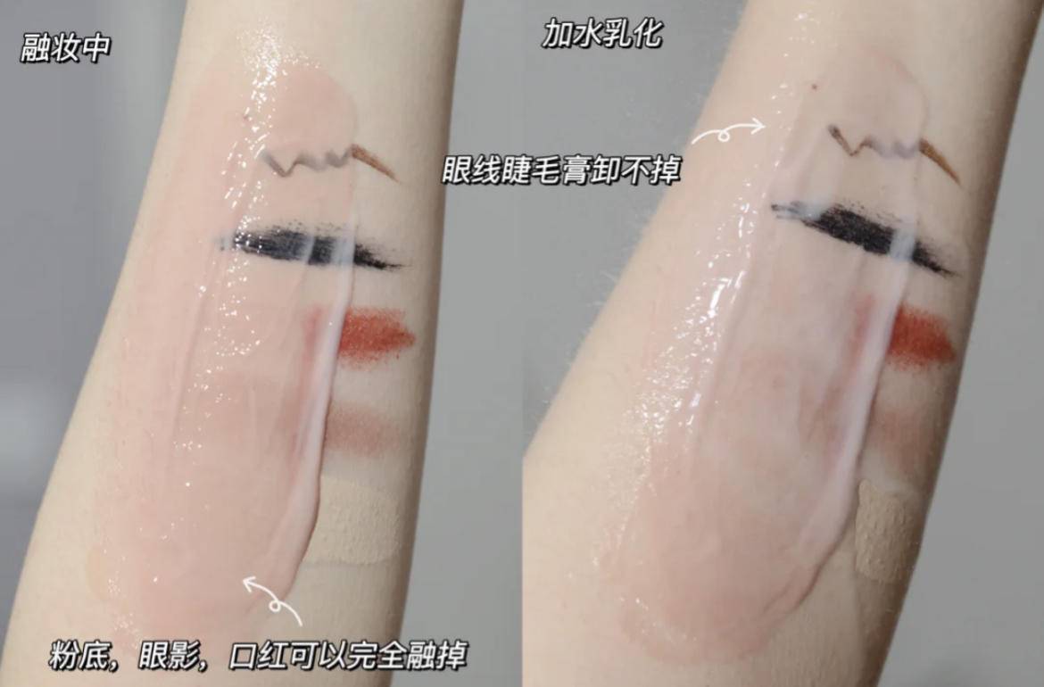 因为|好爽~每个毛孔都在呼吸的感觉太好了！