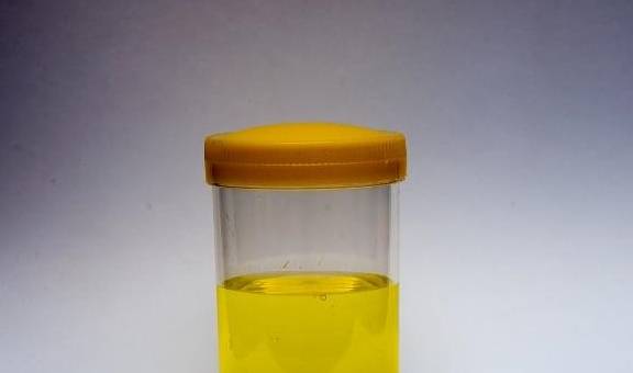 肝脏|肝不好，身体会“说话”？若有这5个信号，可能是提醒你该养肝了