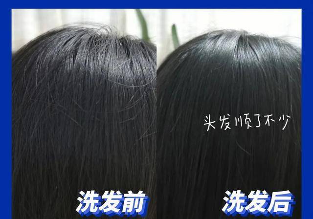 头皮|超难用的洗发水避雷,你中招了吗?