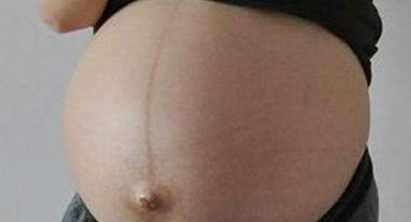 怀孕肚子一条黑线多少周出现 3d1c74ac7c7b4b81a30f2ba68c69750b.jpeg