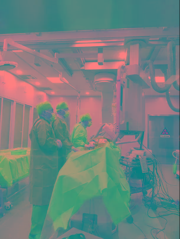 成功|山西省汾阳医院心内一科为一例持续性房颤患者成功实施房颤射频消融术