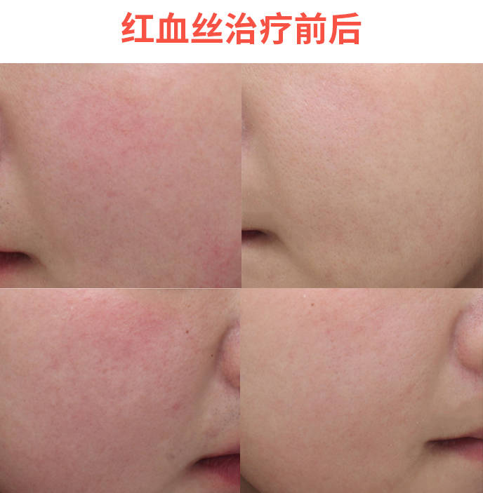 奥运|田志希奥运结束再就业，化身护肤博主，保养理念值得学习