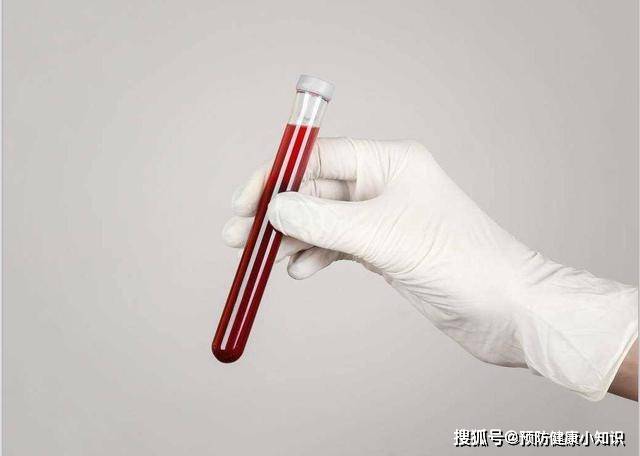 机体|做血常规检查时，若这3个指标升高，建议进一步诊断
