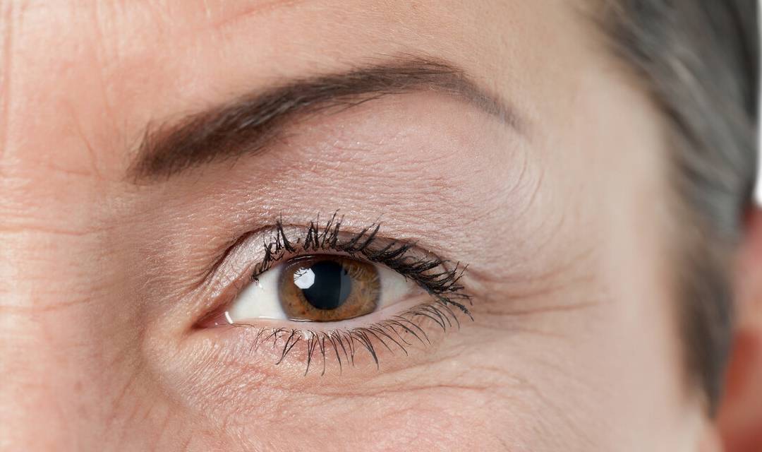 快速去眼角纹 0ee91cce0f354d8884f99846d3c0e893.jpeg