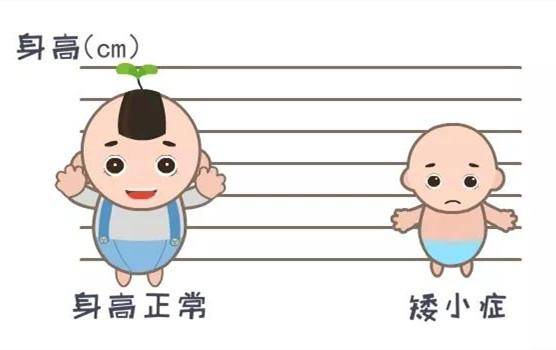 iss) 一组目前病因未明的导致身材矮小疾病的总称,儿童矮小最常见类型